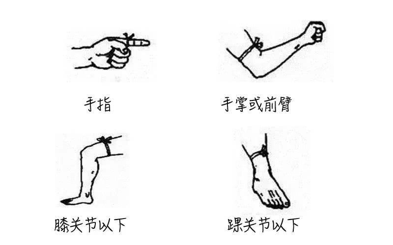  入院|可怕！潮汕两男子先后被同一种毒蛇咬伤入院