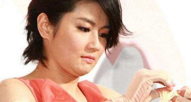  镜头|烧伤第十年面对镜头，Selina哭了！但她不是公主了，不需要可怜