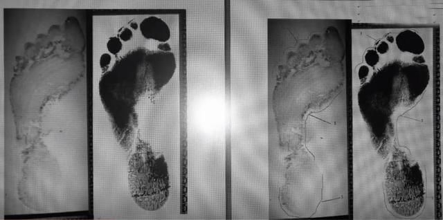  王焕彩|入室强奸案竟现女靴足迹……这些案子咋破的？