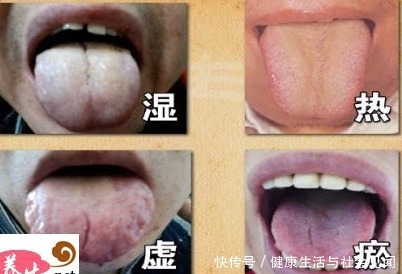 蛋蛋姐|你的身体有没有气虚、血虚、瘀血、寒气、湿气?