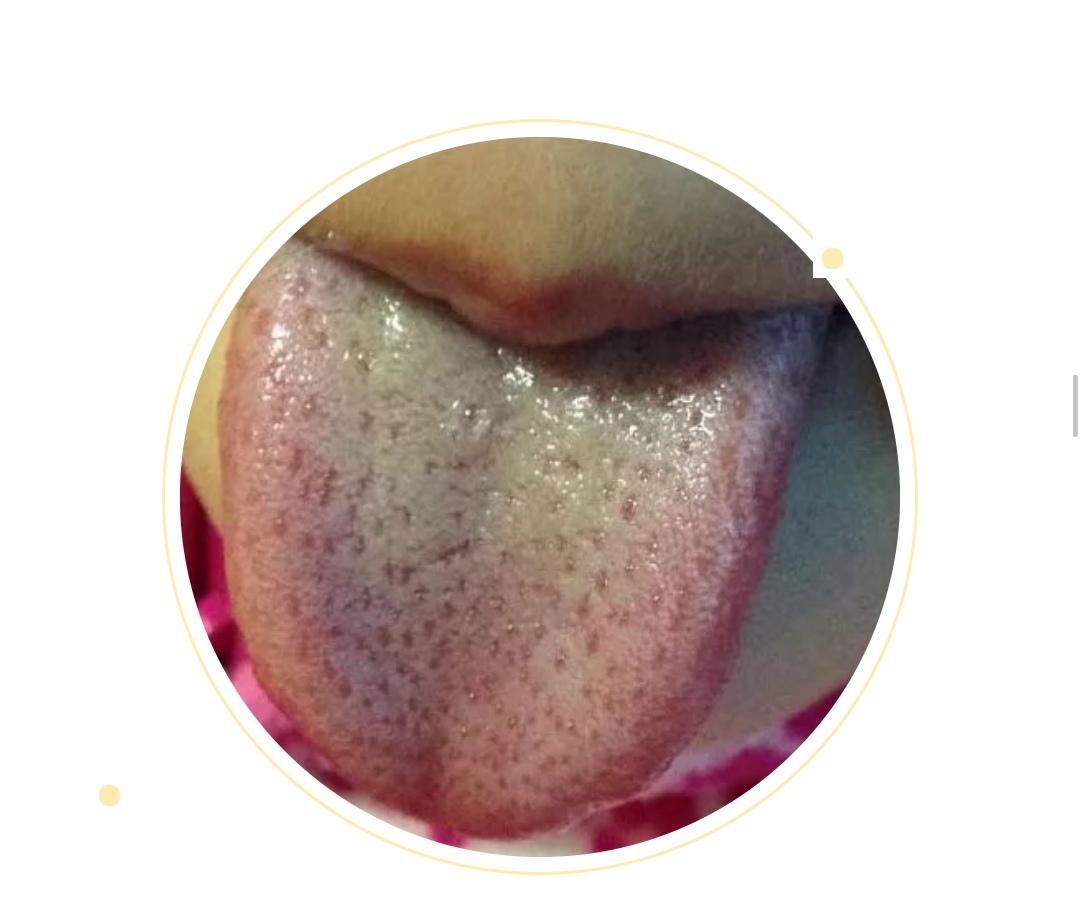  变化|身体健康情况怎么样？可以从舌头进行窥探