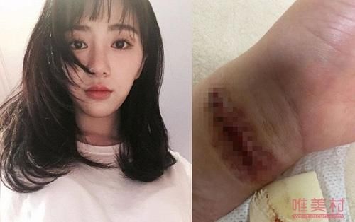 割腕自杀|权珉娥再度割腕自杀 为什么要拿别人的错误惩罚自己