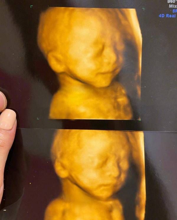  艺人|宁桓宇做爸爸啦！同届快乐男声华晨宇发展最好，其他人都怎么样了？