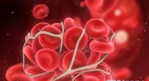  血栓|花生虽然好吃有营养，但这几类人却没有“口福”