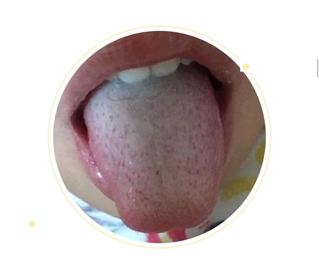  变化|身体健康情况怎么样？可以从舌头进行窥探