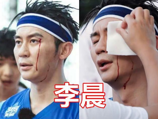  杨颖|明星录综艺节目有多危险？杨颖手骨折，张艺兴昏迷，而他却因此丧命