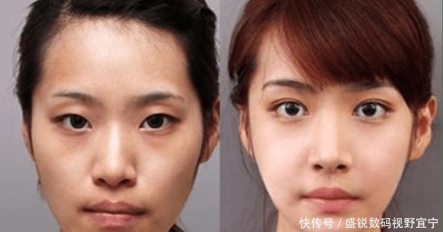  整容|割了“双眼皮”的人, 等老了之后会变成什么样? 答案你可能想不到