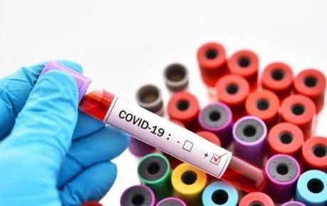  不翼而飞|实验室发布“生化危害警告”运载新冠病毒样本的货车被劫，大量病毒不翼而飞