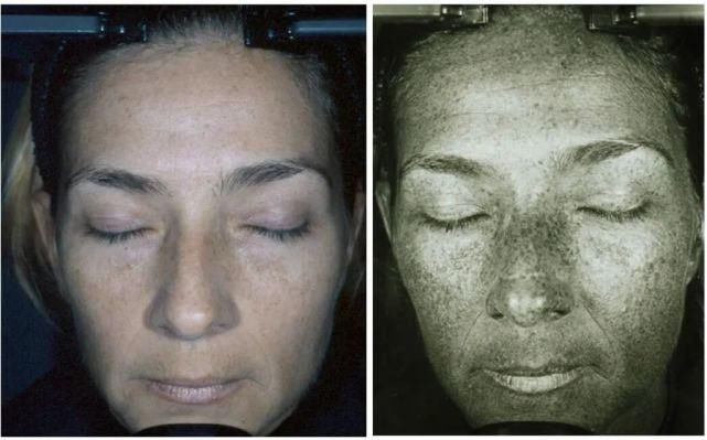 效果|抗老护肤品怎么用，效果最好？丨AD