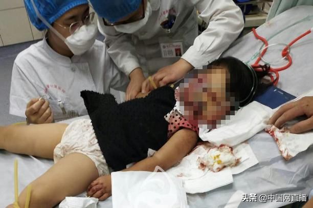  重伤|男子用铁锹疯狂击打祖孙俩 致一死一重伤 警方：嫌疑人已自尽