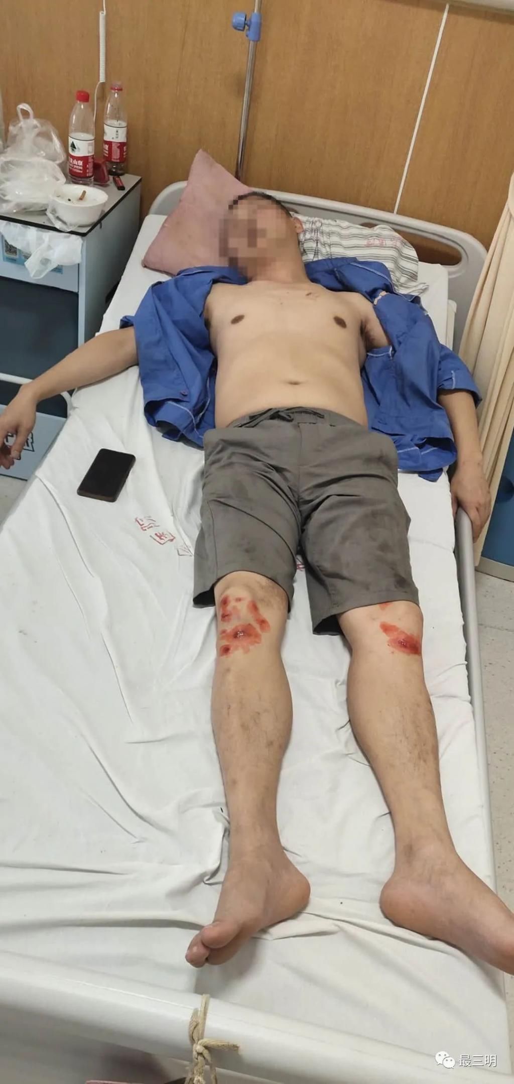 不付|太过份！三明俩男子不付车钱，还当街殴打出租车司机致其住院。