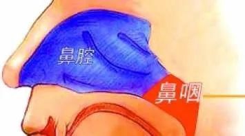  民医院|母子3年内先后查出鼻咽癌！原因竟和浙江人这个习惯有关