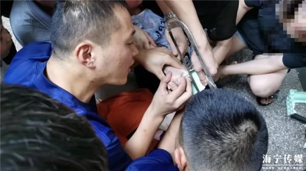  家中|浙江一幼儿手指被“吃”！这种东西家中常见，严重可截肢！