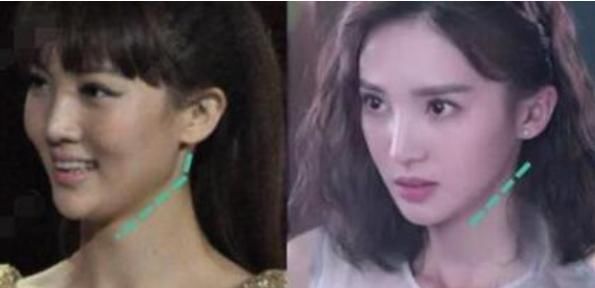  赵丽颖|赵丽颖反击芒果？黄圣依受伤的内幕？杨紫粉丝和李现粉丝互撕了吗