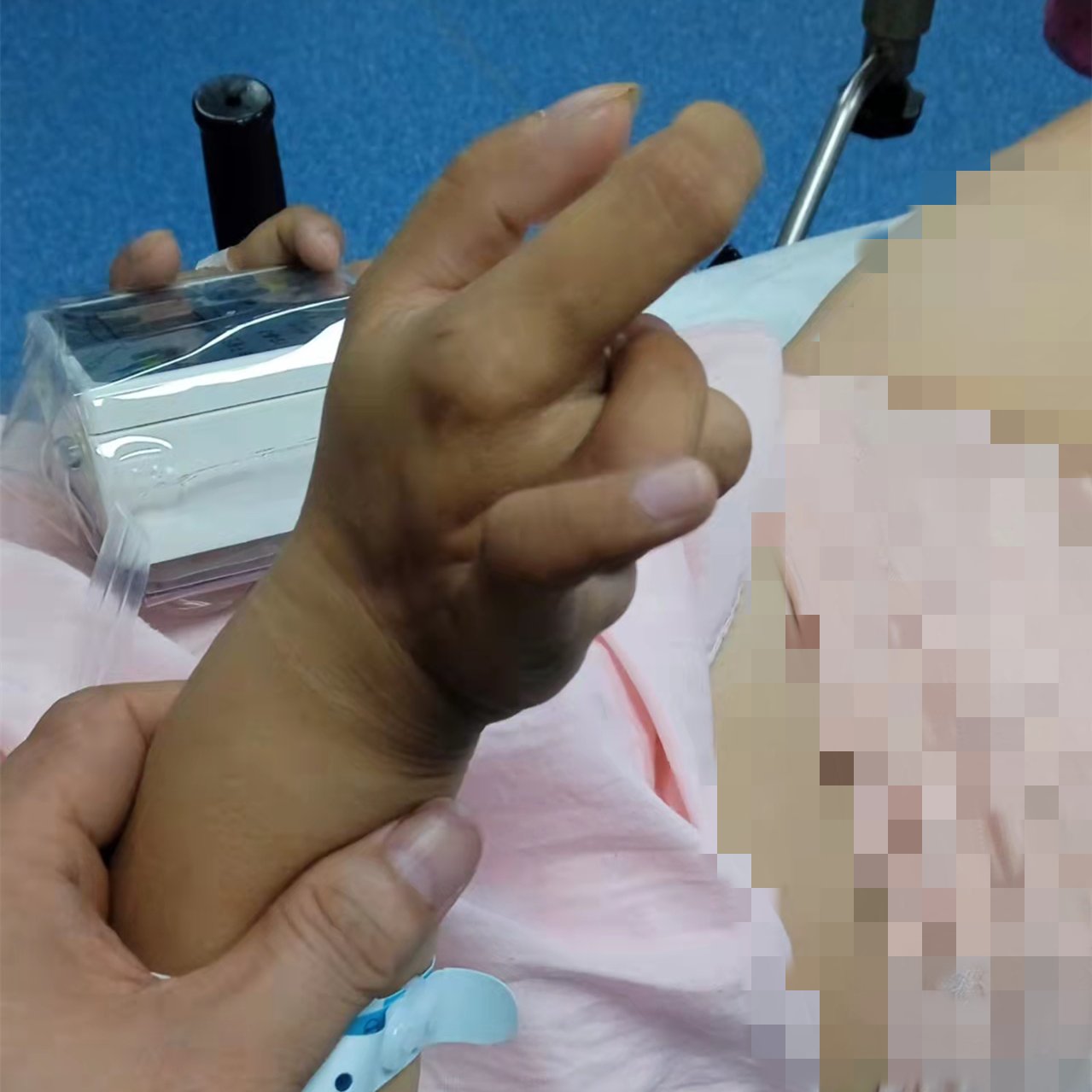 身材矮小的女的可以顺产吗(矮小症产妇一样可以享受到无痛分娩的好处了)