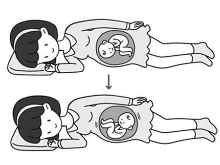 胎儿头位和臀位有什么区别 准妈妈侧卧睡可以正位_【快资讯】