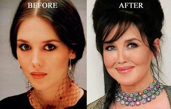 阿佳妮|她是世界最美女星，却沉迷玻尿酸搞僵脸，今65岁瘦身成功颜值回春