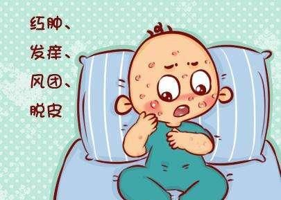  吃海鲜|吃海鲜如何防过敏？3个问题要注意