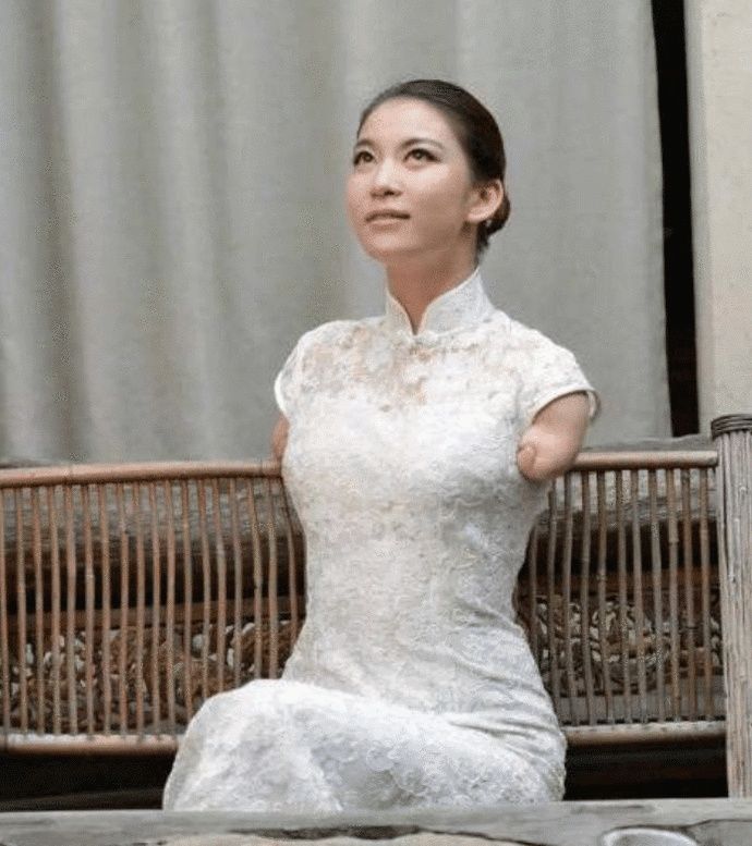  非诚|非诚勿扰中“无臂女孩”与小伙牵手后，紧接着被甩！她近况如何？