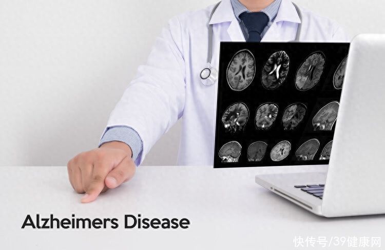 年纪大了害怕脑萎缩？好心提醒：3种药，用得越早，效果或越好2023