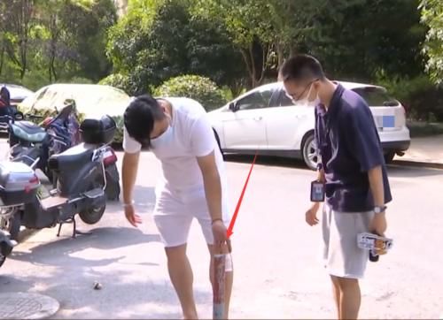  刮伤|被挡车柱刮伤腿，业主认为有安全隐患，物业却一分都不赔