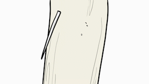 异物|杭州一女子胃内惊现14cm大勺子!原因竟是……