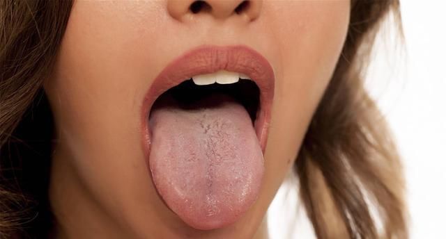  之气过重|湿气重的人，身体一般会出现“3黄”，学会祛湿方法，无湿一身轻