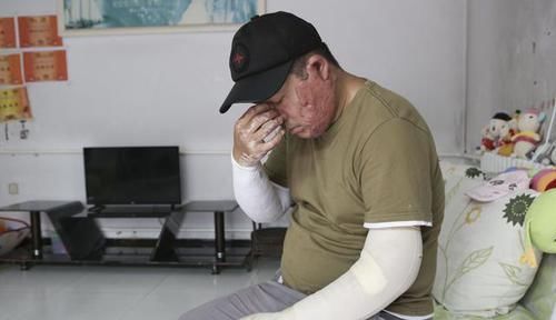  女孩|偷油贼焚车引发车祸致1死2伤，疑犯归案10岁女孩却惨遭毁容