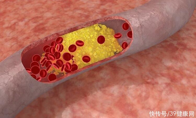 研究发现腿粗屁股大更容易长寿(身材决定寿命？研究发现：大腿粗、屁股大的人，可能更长寿)