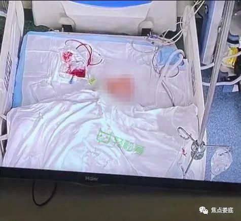  女童遭|6岁女童遭邻居男用锄头挖裂头骨，为何如此心狠手辣！