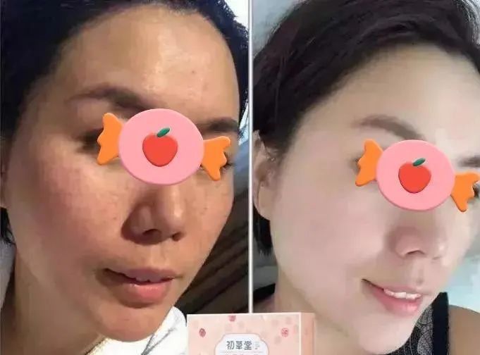  健脾|三伏天吃这种糕，健脾祛湿瘦得快，错过等一年！