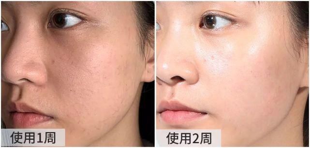  近照|61岁“少女脸”奶奶近照被扒！看完这张脸，6亿直男在线表白：美得太犯规！