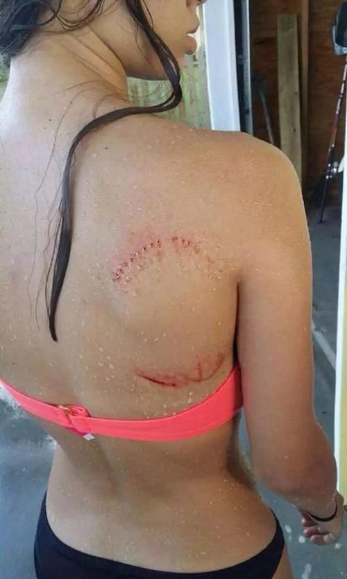  当场|生活中38个最危险的瞬间，离当场去世就差那么0.01秒