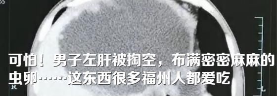  火灾|突发！福州市区一单元房火灾！消火栓没有一滴水流出来……