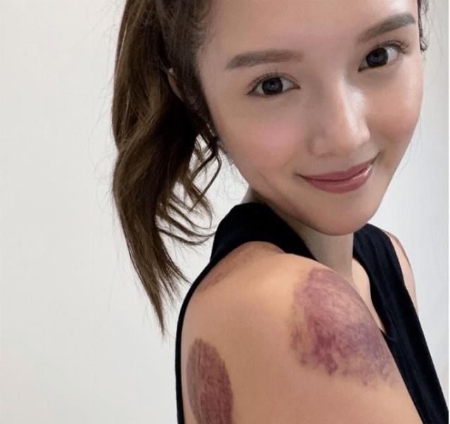 体力|《七公主》煞科，TVB女星体力透支：去拔罐好黑好爽