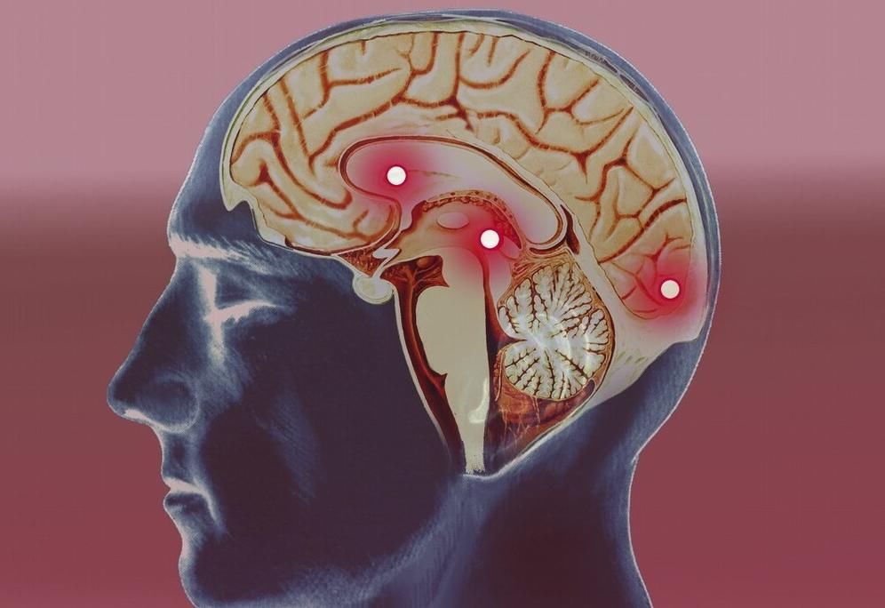  不利于血|“脑梗”拖不得，医生告诫：身体发出4个信号，赶紧去医院就诊