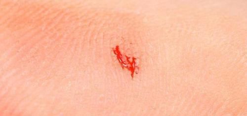 血糖|血糖若“失控”了，身体可能有5种迹象，常吃2物，血糖或不敢放肆