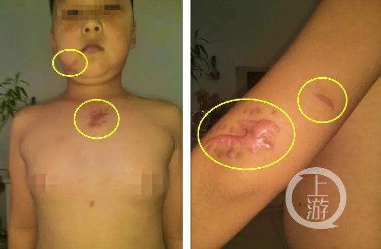 重伤|大庆一男子行凶致三死一重伤：第三次作案时坠楼身亡，动机至今不明