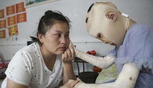  女孩|偷油贼焚车引发车祸致1死2伤，疑犯归案10岁女孩却惨遭毁容