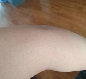 部位|怎样坚持拍打同一个部位一小时?