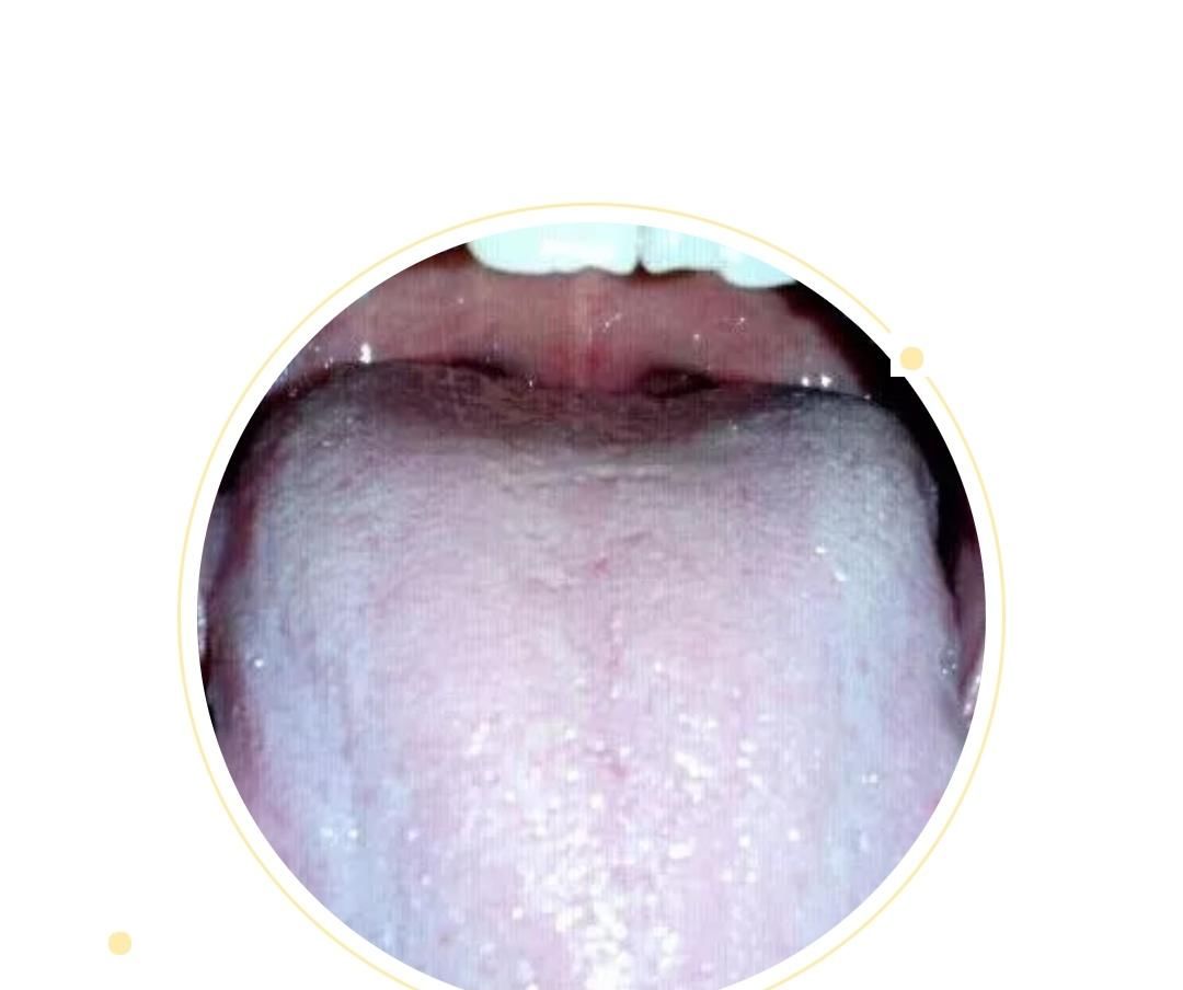  变化|身体健康情况怎么样？可以从舌头进行窥探