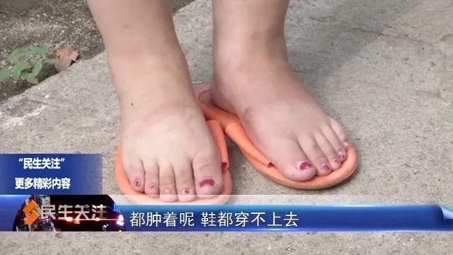  常女士|送餐途中出意外 理赔问题起纠纷