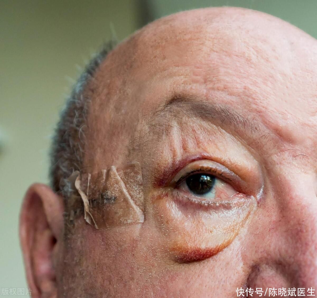 血常规能看出心脏有问题吗(心脏好不好，脸上先知道？若出现这3点症状，赶快去查一下血常规)