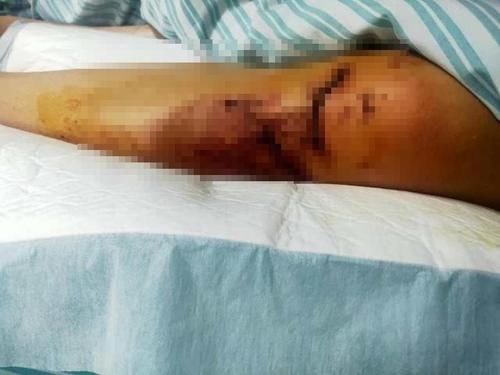 悬崖|3岁儿子景区小便,母亲被推下20米悬崖,索赔150万?警方回应!