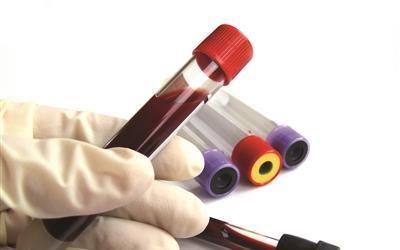 老年痴呆|人过中年为啥要查同型半胱氨酸水平高低？不想老年痴呆就去查一查