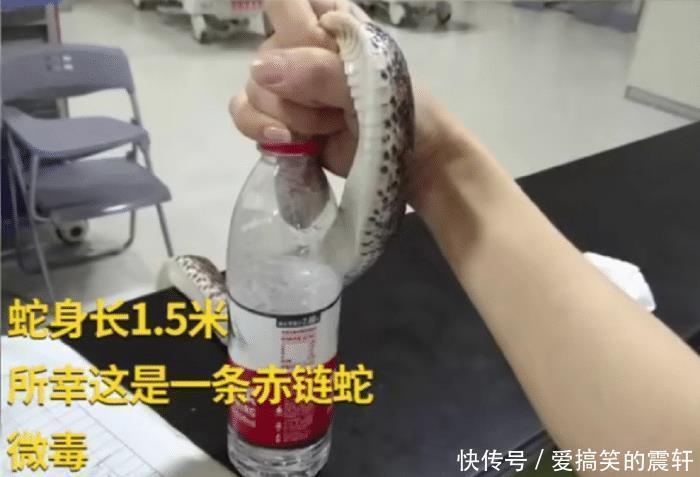  就医|大心脏女子草丛捡手机被蛇咬，手提活蛇淡定排队就医