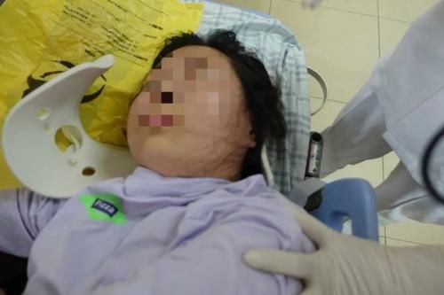  厚街交警|女子骑电动滑板车驶入机动车道被撞，幸亏有这条“绿道”……