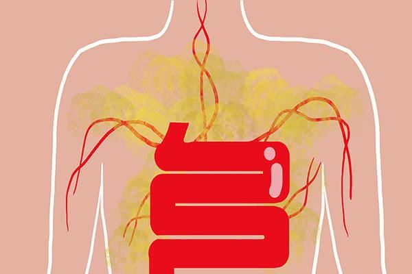  疾病|频繁放屁，真的是身体排毒？别忽视，也可能是疾病信号