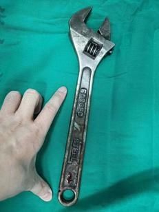 医生|惊险!工友不慎被扳手插入颈部 多学科医生合力抢救成功