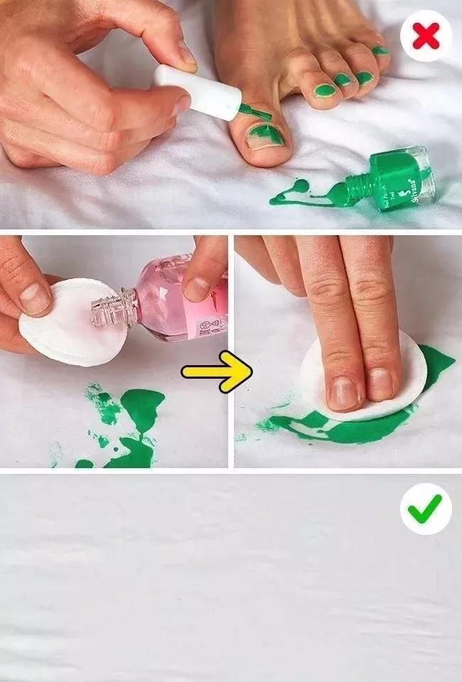 发黄|衣服发黄，别用漂白剂了，水里加点它，比新买的还干净！